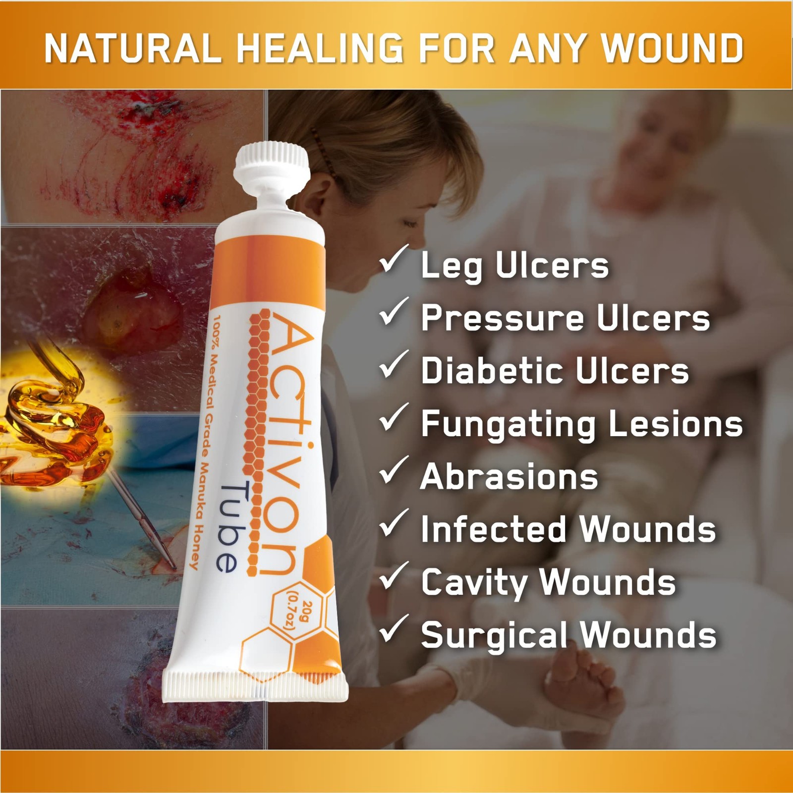 Activon Medical Grade 100% Manuka Honey Gel Tube Natural Healing of Wounds 3 …